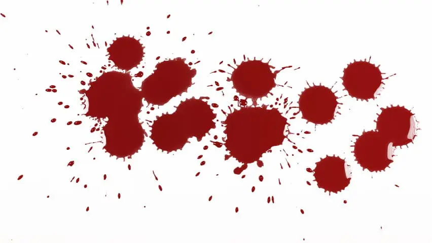 You are currently viewing How To: Remove Blood Stains From Carpet